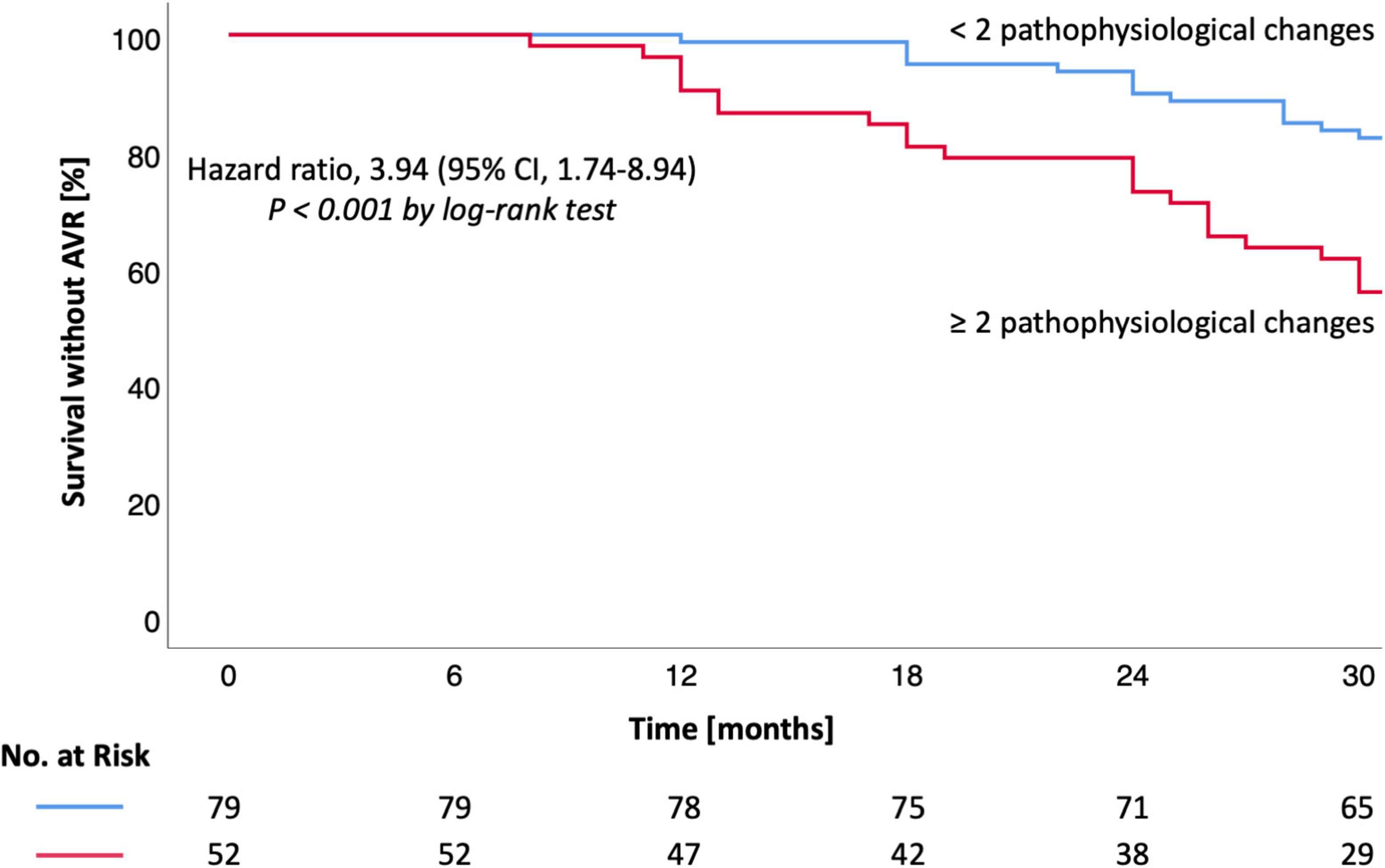 Left ventricular hypertrophy, diastolic dysfunction and right ventricular load predict outcome in moderate aortic stenosis